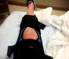 Runner resting with a knee brace after the Ouachita Trail 50K ultramarathon.